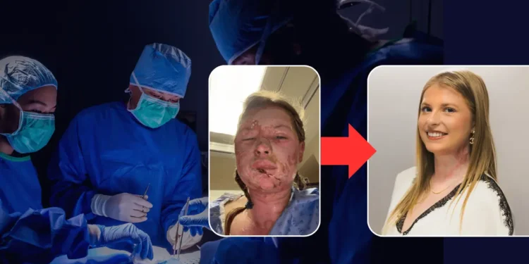 Kaitlin Jeffrey exosome burn treatment